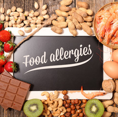 Food Allergens image